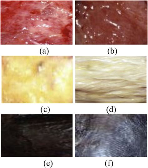 Cropped different color portion extracted from different... | Download Scientific Diagram