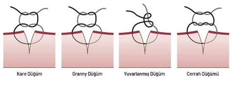 Suture Techniques Used in Veterinary Surgery - Boz Medical