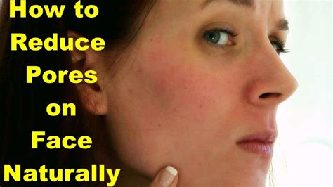 How to Reduce Pores on Face Naturally | Remove Large Pores in 1 Day ...