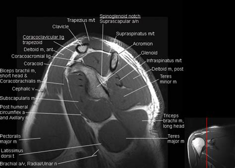 Shoulder Joint Anatomy Mri