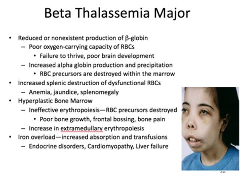 b-thalassemia major Flashcards | Quizlet