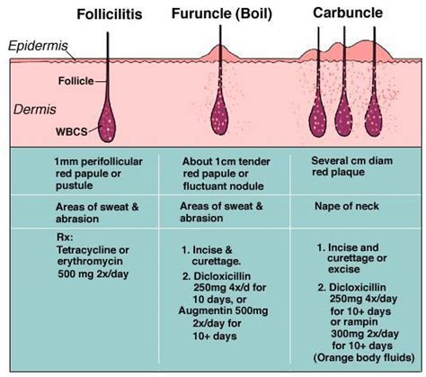 furuncle vs carbuncle - Yahoo Image Search Results | integumentary ...