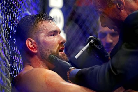 Chris Weidman Has No Regrets From Loss To Jacare Souza