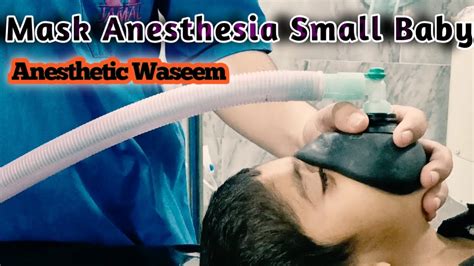 General Anesthesia Mask Procedure | Mask Anesthesia Small Baby Procedure | Anesthetic Waseem ...