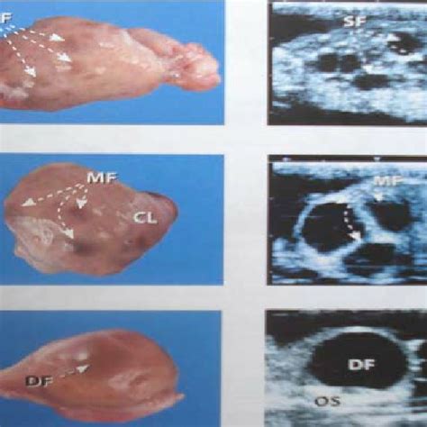 Ultrasound image of ovary with surrounding follicles [29]. | Download ...