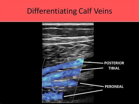 Ultrasound Registry Review - Extremity Venous