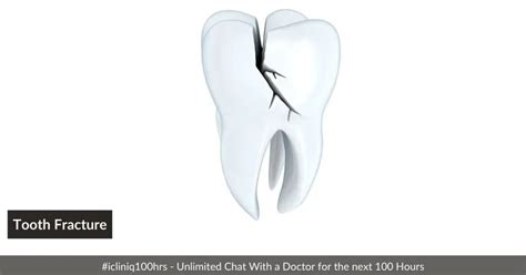 Tooth Fracture - Types | Causes | Symptoms | Diagnosis | Treatment