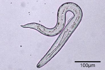 Angiostrongylus vasorum third stage larva released from slug tissue (... | Download Scientific ...