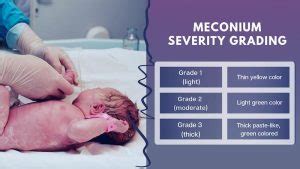 Meconium Aspiration Birth Injury Lawsuits | Malpractice Lawyers