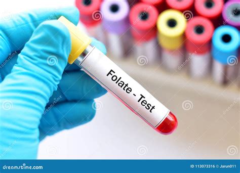 Blood Sample for Folate Test Stock Photo - Image of nutrition, anaemia: 113073316