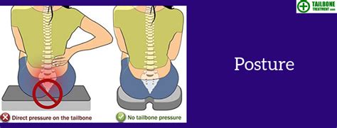 Best Tailbone Treatment Specialist | Coccyx Pain Specialist