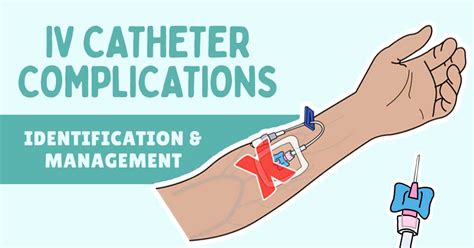 IV Infiltration and other IV Catheter Complications: Identification and Management | Health And ...