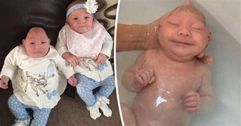 Miracle baby born without 90% of brain defies medics: 'Her twin can't ...