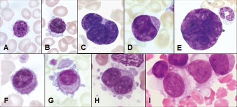 Platelet morphology