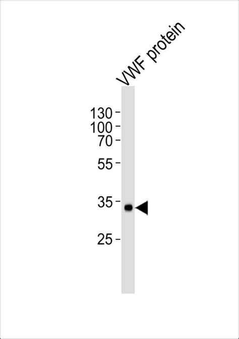 Anti-VWF / Von Willebrand Factor Antibody | Mouse anti-Human | LSBio