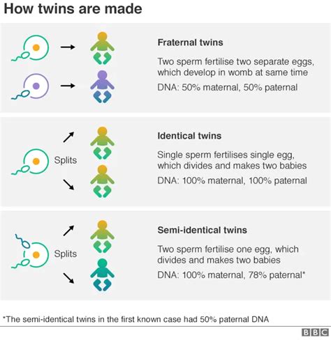 Semi-identical twins 'identified for only the second time'