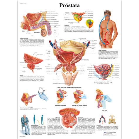 Próstata - 4006862 - 3B Scientific - VR3528UU - Urinary system charts and posters