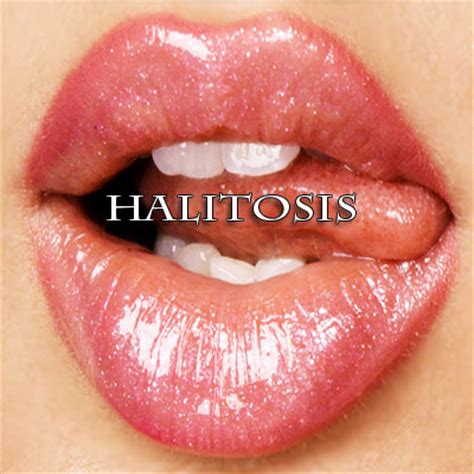 Halitosis