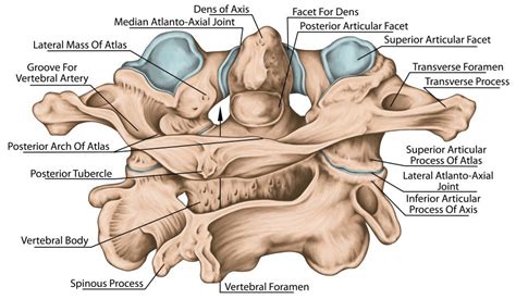 Cervical Fracture - Advanced Orthopedic & Sports Medicine Specialists