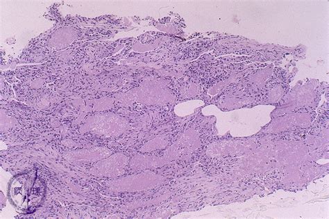 Histology Of Pleura