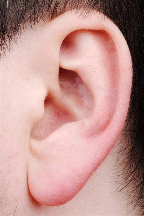 Popped cyst in earlobe - Answers on HealthTap