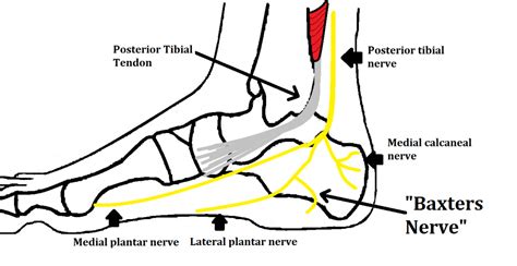 Baxter’s Nerve Entrapment - Peak Podiatry