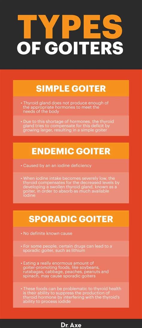 Goiter Symptoms Treatment