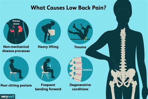 Back Pain: Causes, Treatment, and When to See a Doctor