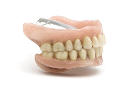 Dental prosthesis stock photo. Image of oral, prothesis - 13198944