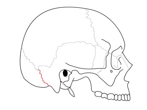 File:Occipitomastoid suture.png - Wikipedia