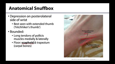 Anatomical Snuff Box Boundaries