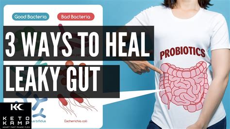 Leaky Gut Treatment & Symptoms | Foods That Cause Leaky Gut | Supplements For Gut Health - YouTube