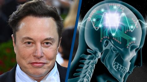 Elon Musk's Neuralink Implants Wireless Brain Chip In Human - TheBravoNerd - "MovieTech Junction"