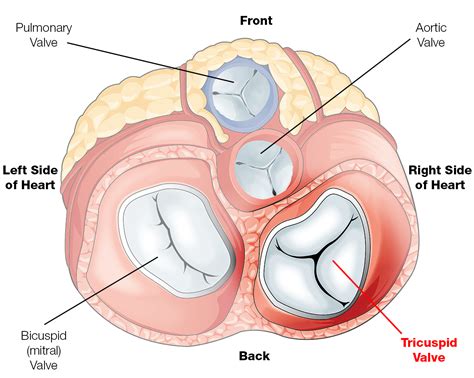 Tricuspid Valve Disease | The Patient Guide to Heart, Lung, and Esophageal Surgery