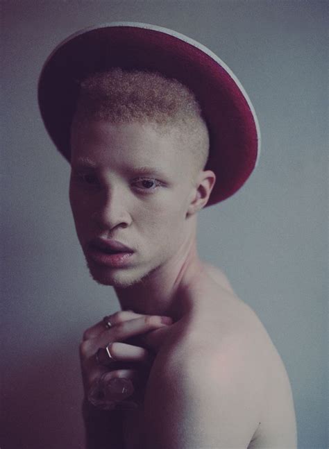 Shaun Ross / Naomi Shon photography Albino Human, Header, Shaun Ross, Stephen Thompson, Urban ...