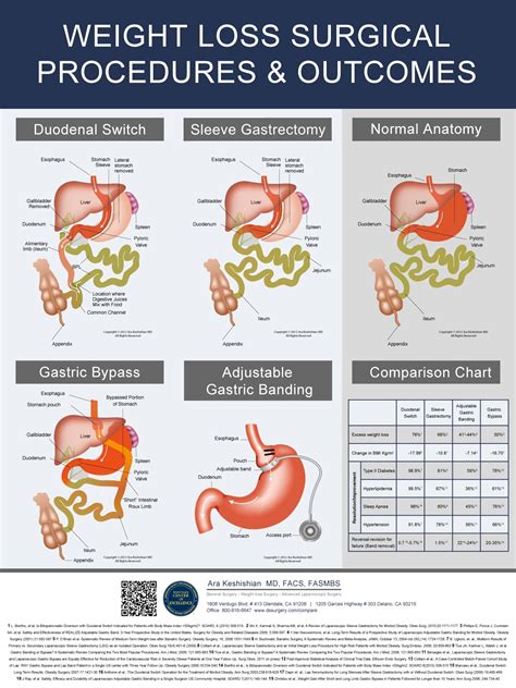 Gastric Sleeve Diet, Gastric Sleeve Surgery, Weight Loss Plans, Weight Loss Tips, Lose Weight ...