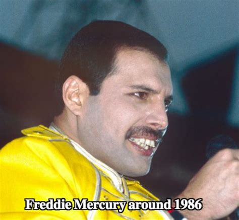 Freddie Mercury Teeth - Did They Help Queen? - Latest Plastic Surgery ...