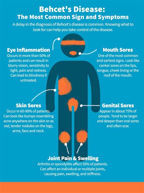 Behçet’s Disease Symptoms: Understanding the Common Signs - Celgene | Behcets disease, Behcets ...