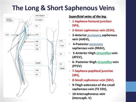 Varicose veins by M.Fathy Zaidan