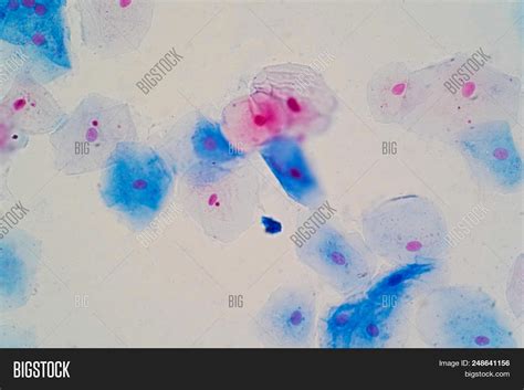 Squamous Epithelial Image & Photo (Free Trial) | Bigstock