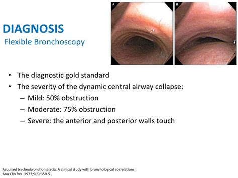 Dynamic Central Airway Obstruction: Tracheomalacia, Tracheobronchomal…