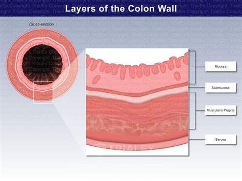 Layers of the Colon Wall - Trial Exhibits Inc.