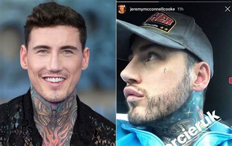 Male celebrities with lip fillers