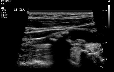 Ultrasound (US) – Undergraduate Diagnostic Imaging Fundamentals