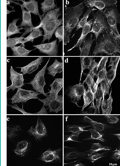 Figure 2 from Effects of MLS laser on myoblast cell line C 2 C 12 | Semantic Scholar