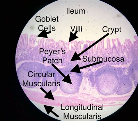 Ileum Histology.