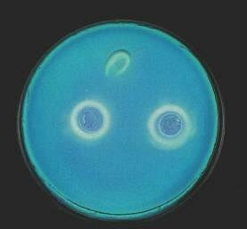 -Images of Petri dishes containing recombinant yeast colonies. a) Petri ...