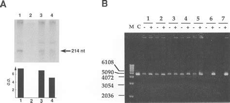 Assays for nuclease activity in nuclear extracts. (A) Assay for RNase... | Download Scientific ...