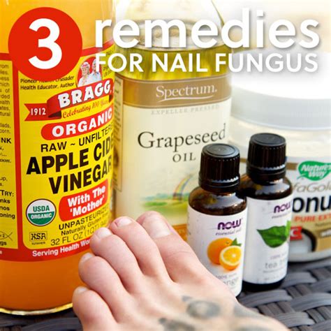 3 Simple Home Remedies for Toenail Fungus | Everyday Roots