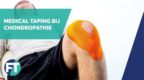 Tapen bij chondropathie | Medical Taping | FysioTape - YouTube